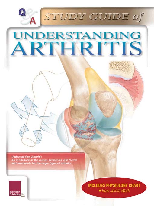 Title details for Arthritis Study Guide by Scientific Publishing, Ltd. - Available